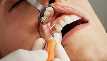 tandartsbehandeling gereedschap
